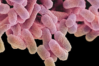 Forrás: AFP/Science Photo Library