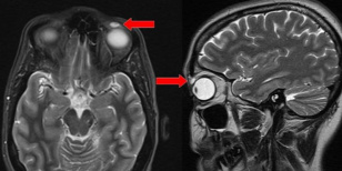 Forrás: BMJ Case Reports 2018